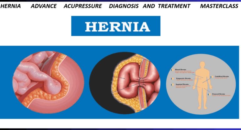 HERNIA - ADVANCE ACUPRESSURE DIAGNOSIS AND TREATMENT MASTERCLASS
